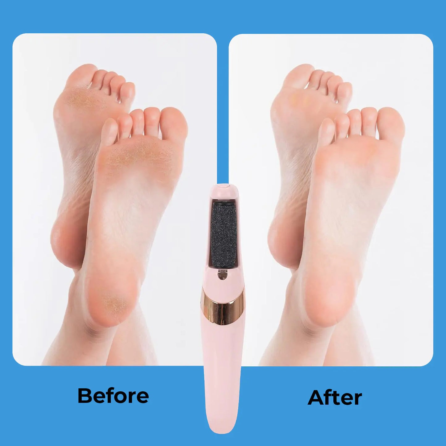 Electric Foot Callus Remover